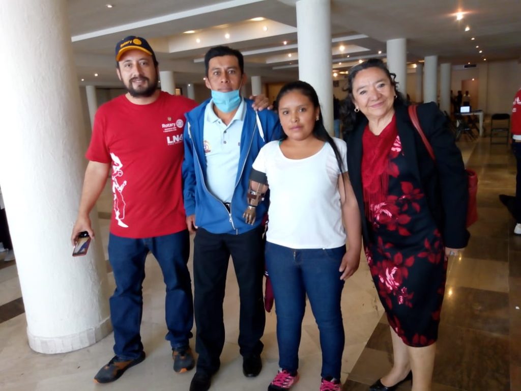 Joven de Tepatlaxco recibe prótesis