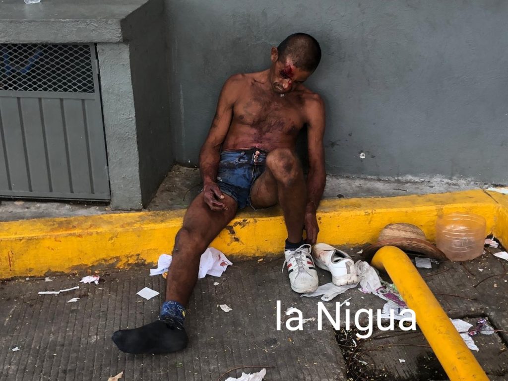 Hayan a un hombre ensangrentado y tirado
