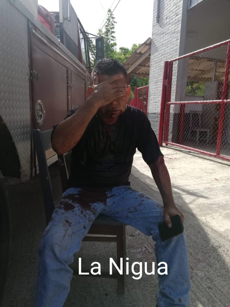 Atracan a balazos a comerciante en Papantla