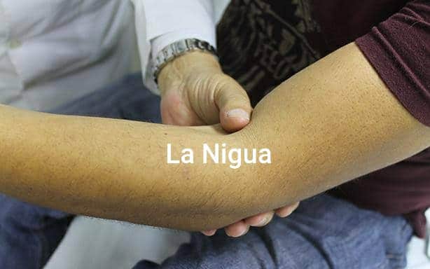 IDENTIFICAR TEMPRANAMENTE HEMOFILIA; PIDE IMSS VERACRUZ SUR A PAPÁS VIGILAR A MENORES 1 20210418 0253366892290612953559529