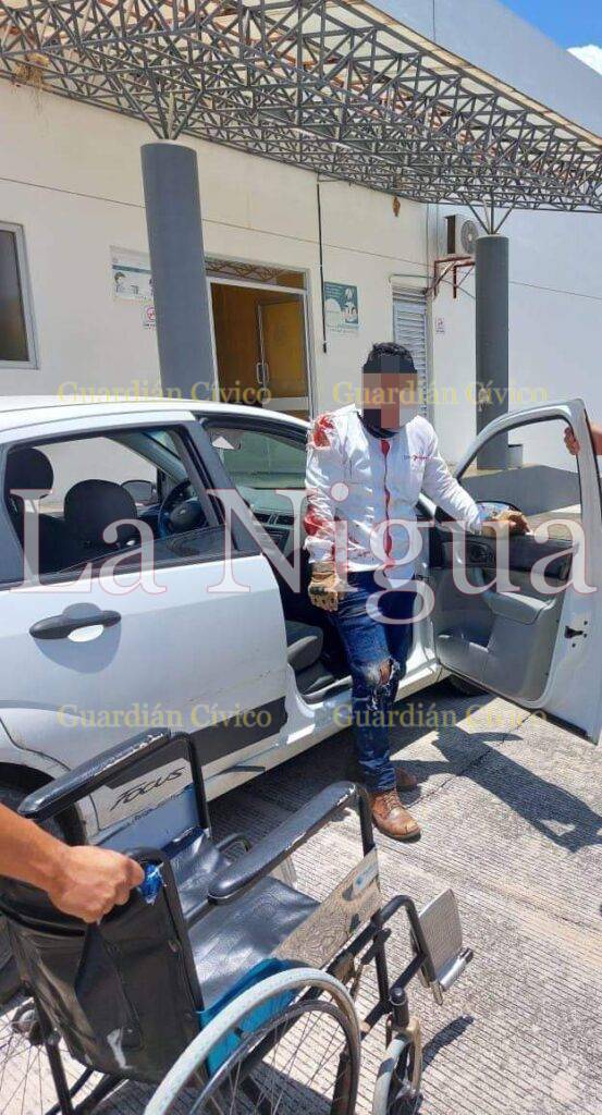 Lesionan a hombre en intento de robo en la carretera federal 105 México – Tampico