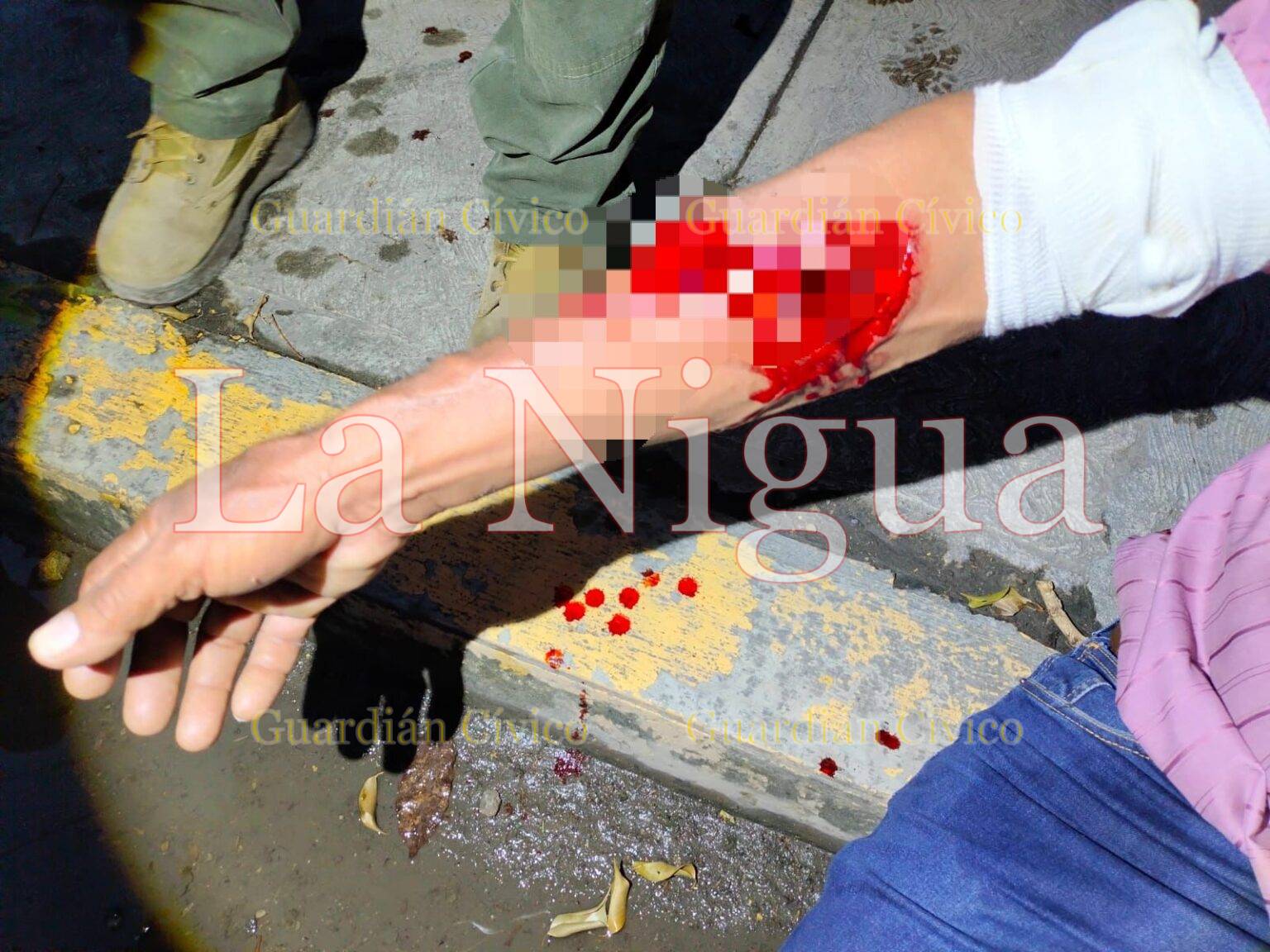 Auxilian a hombre tras ser atacado por un perro