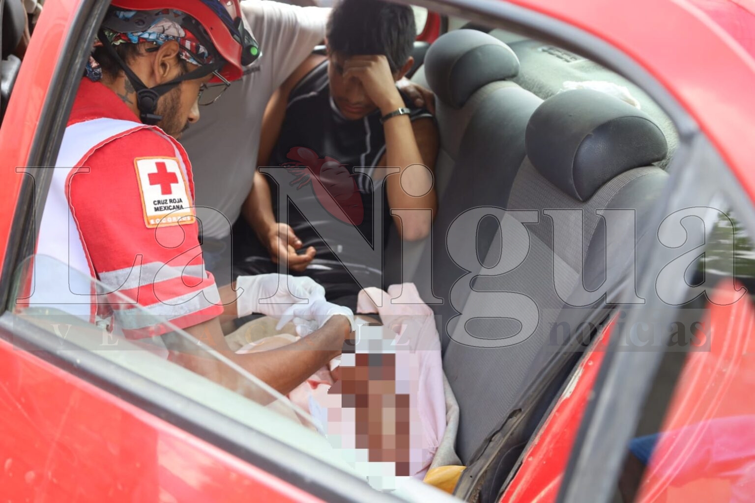 Ciclista se revienta la pierna tras caída de su motocicleta