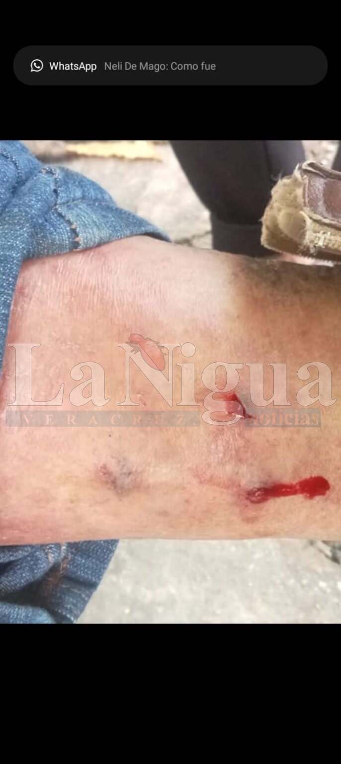 Masculino es atacado por un pitbull en Las Choapas