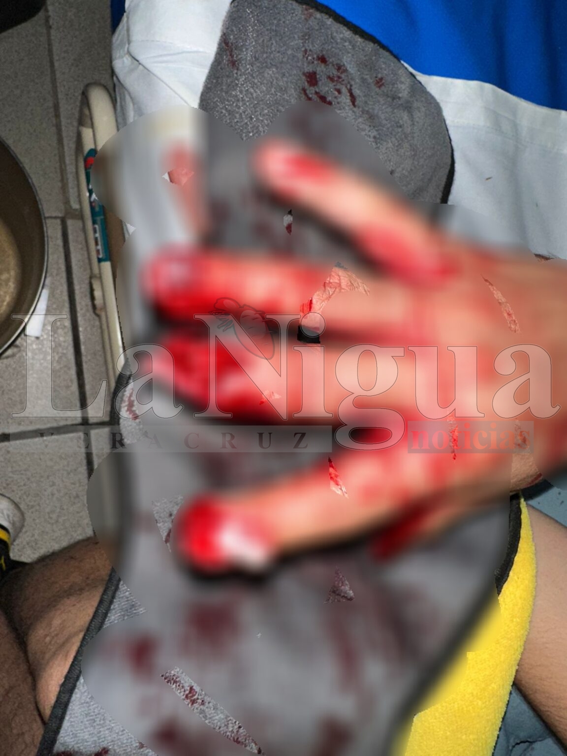 Pierde los dedos echando cohetes