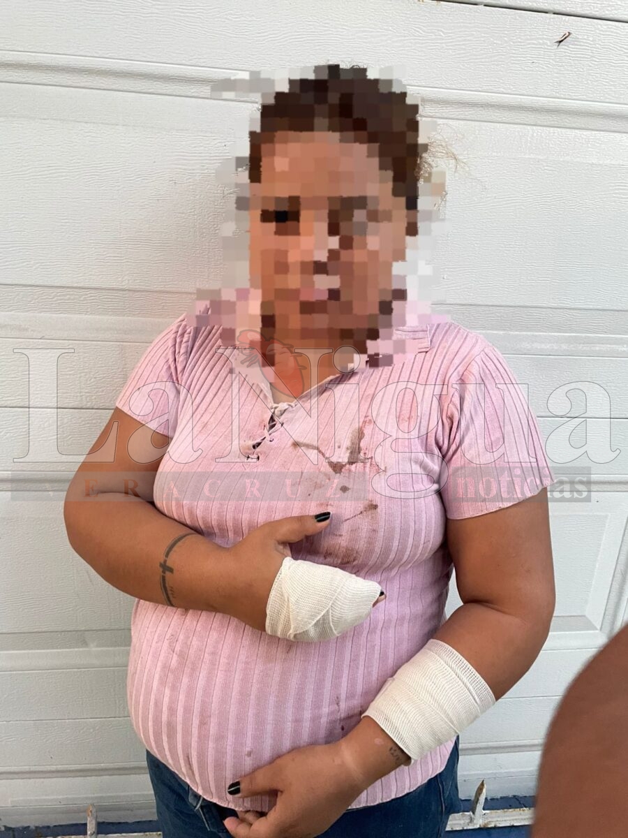 Joven embarazada teme por su seguridad tras brutal agresión en Las Choapas