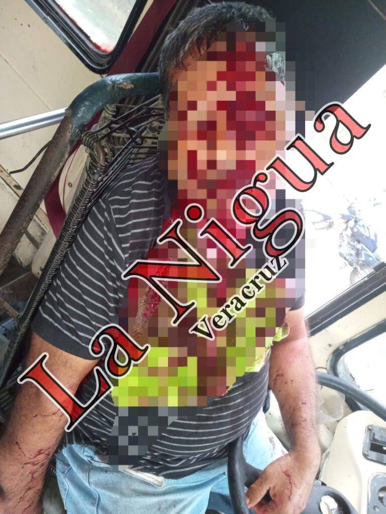 En pleito por pasaje, matan a chófer