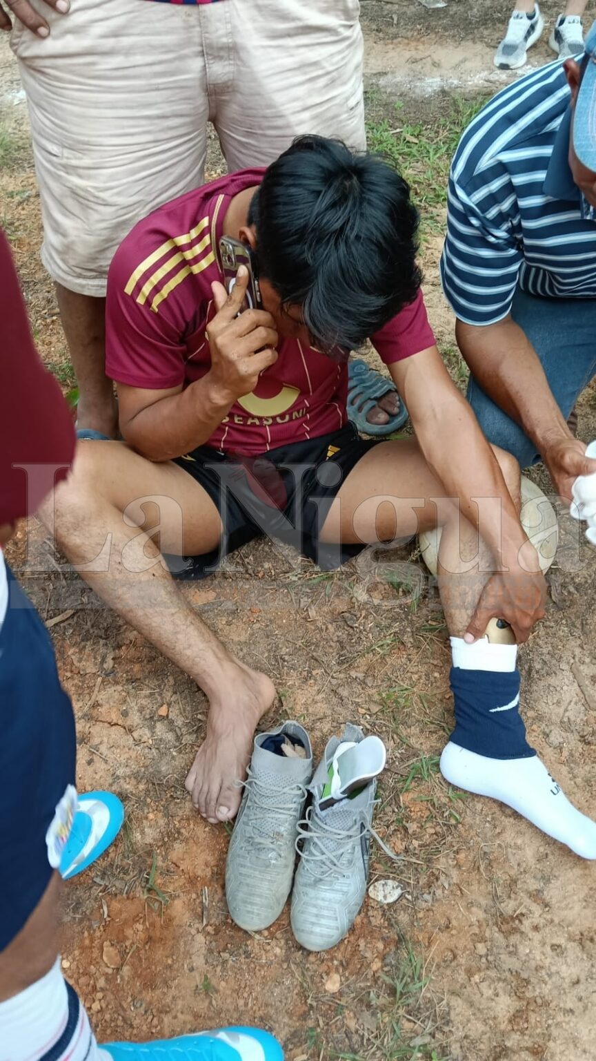 Se fractura jugador de fútbol en Las Choapas