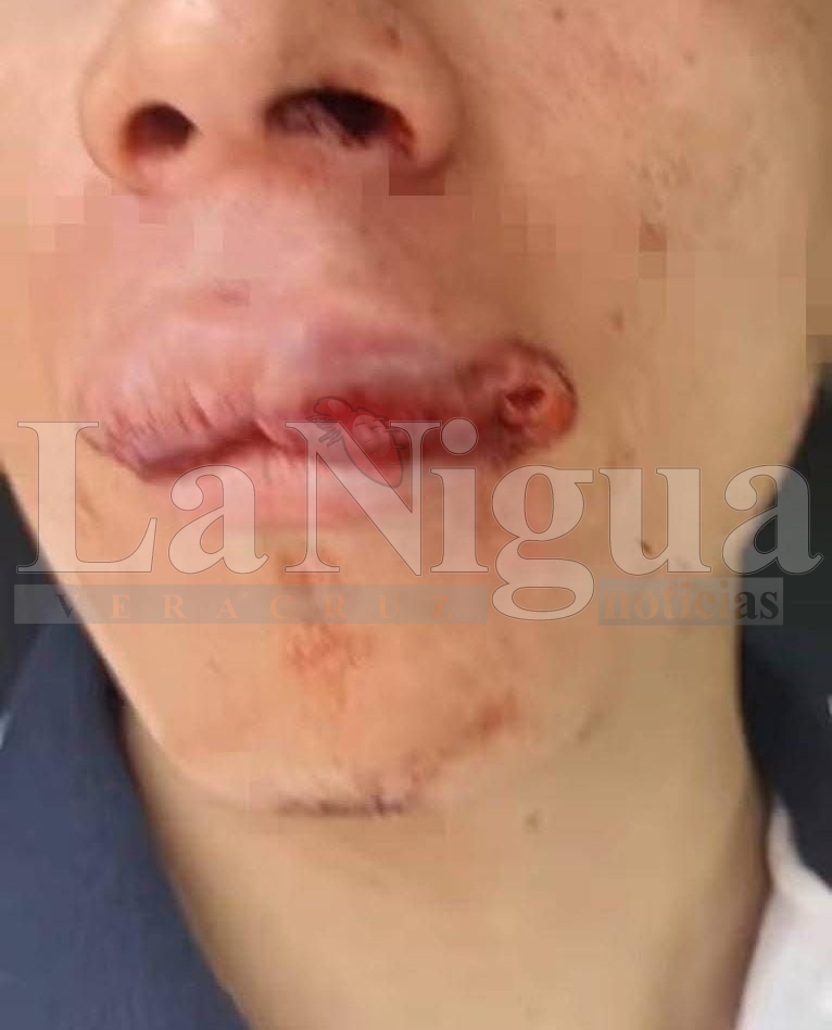 Padres procederán legalmente contra agresores de estudiante del ESBAO de Córdoba 1 img 20250401 wa01372517536254849605009