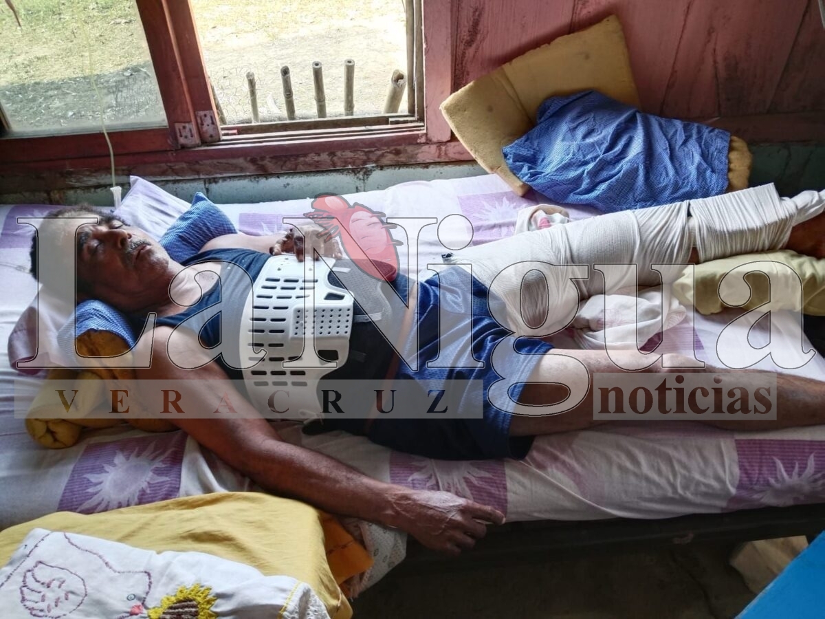 Būfala cimarrona lo ataca y le fractura una pierna y una costilla en Playa Vicente 4 img 20250424 wa01313631801956839764871
