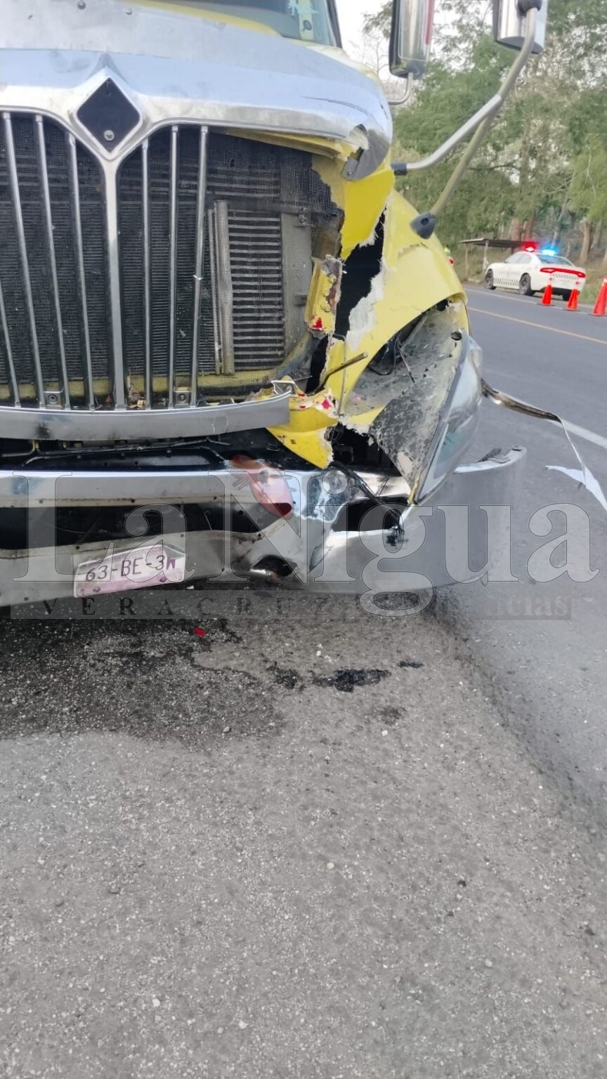 Muere joven de la Arena/Loma Bonita al chocar su moto contra tracto camión