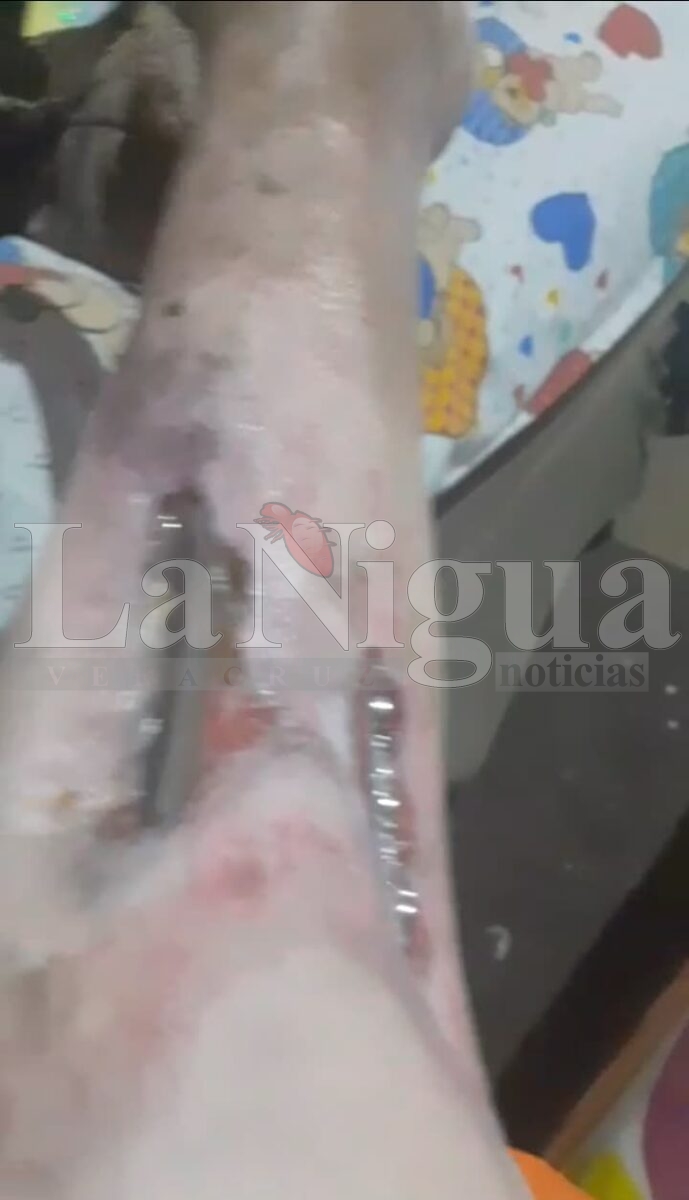 Paciente Denuncia Retraso Quirúrgico por Falta de Material en Hospital del IMSS