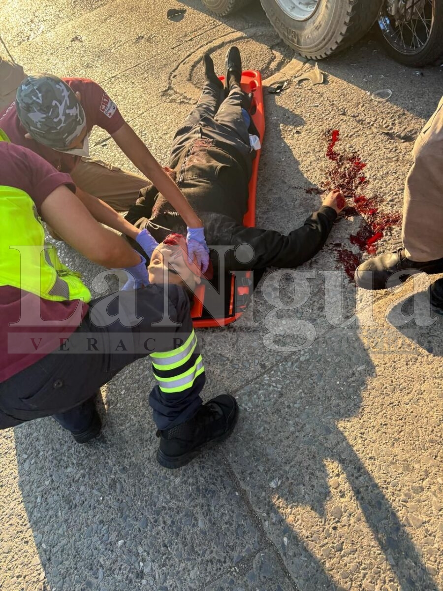 Motociclista resulta gravemente herido tras chocar contra tráiler en Fortín 17 img 20250705 wa00226159019888119189927