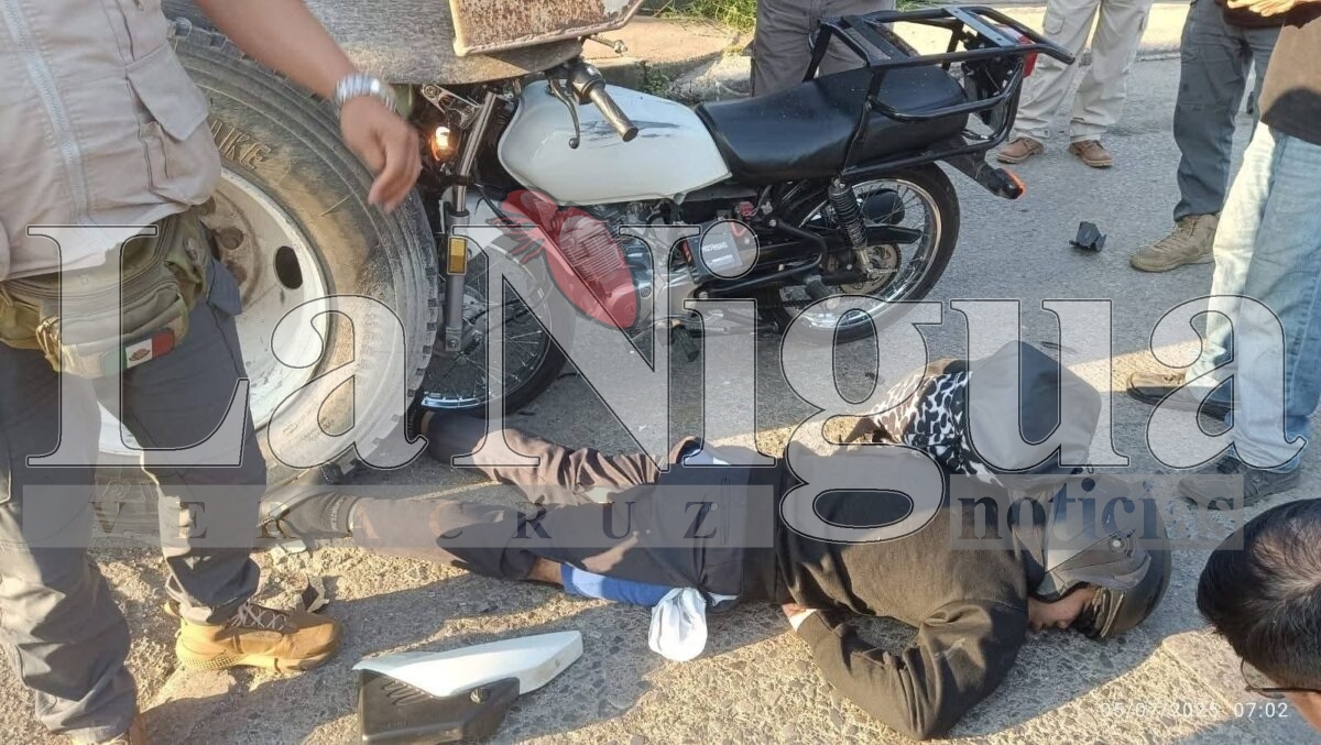 Motociclista resulta gravemente herido tras chocar contra tráiler en Fortín 3 img 20250705 wa00335685770991777941316