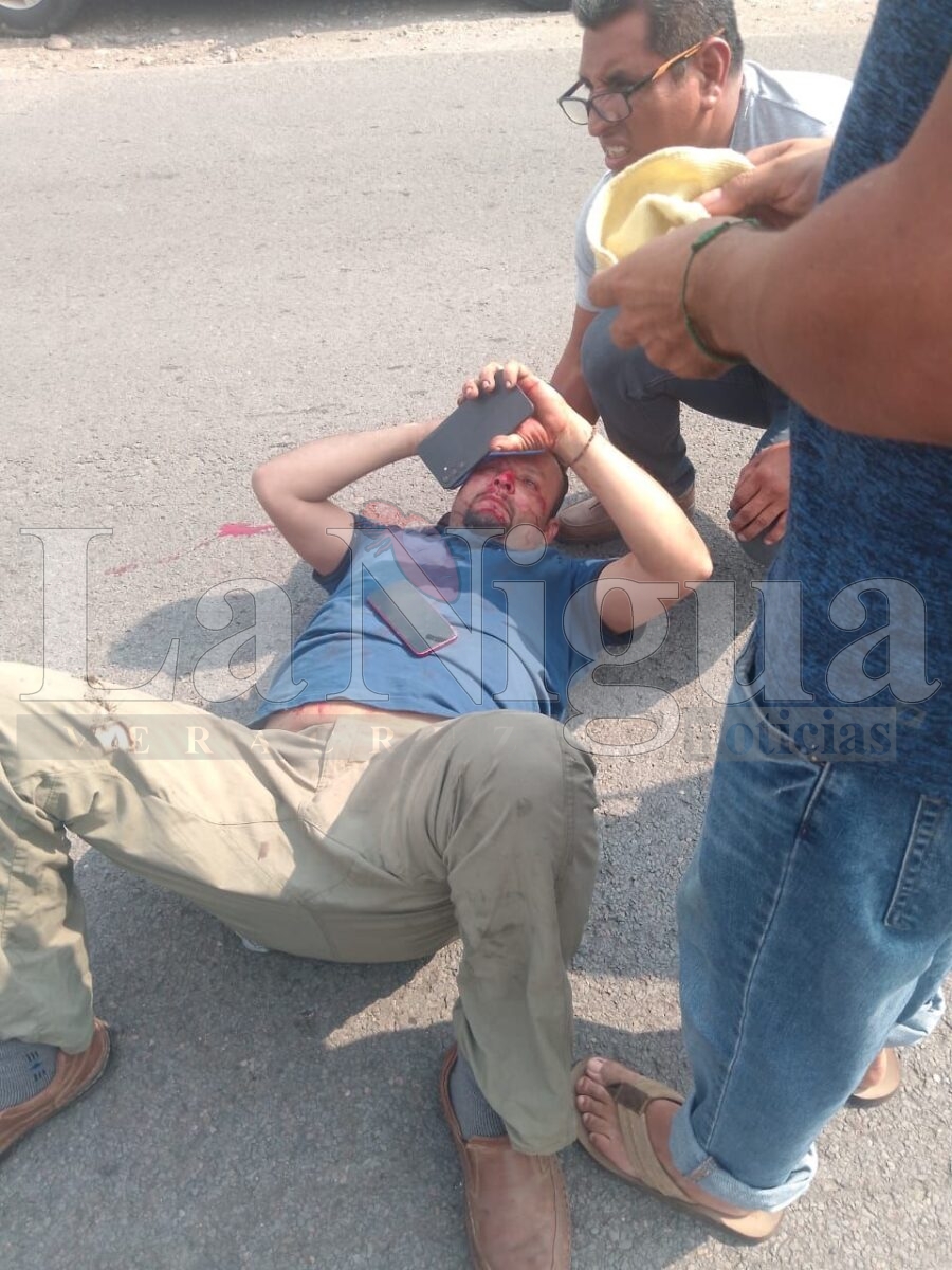 Motociclista resulta lesionado tras derrapar en la carretera Córdoba-Veracruz 2 img 20250714 wa01007607509312868280302