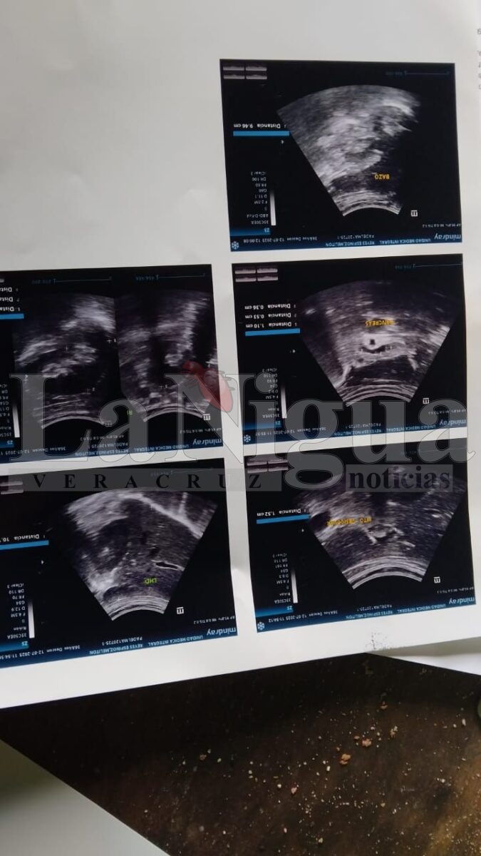 Solicitan apoyo para cubrir cuota hospitalaria 2 img 20250731 wa00195220184336460527605