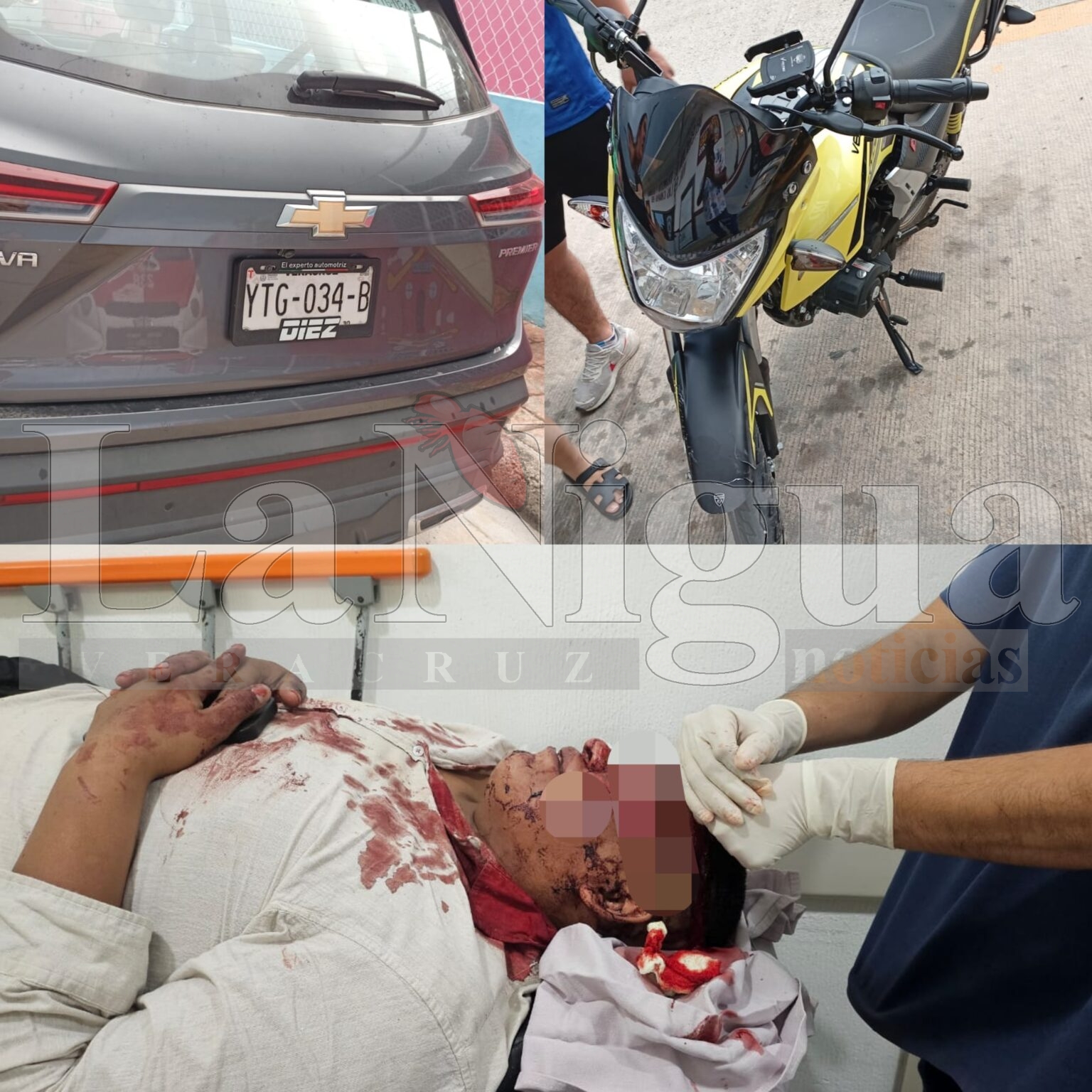 Grave motociclista tras chocar contra camioneta en Las Choapas