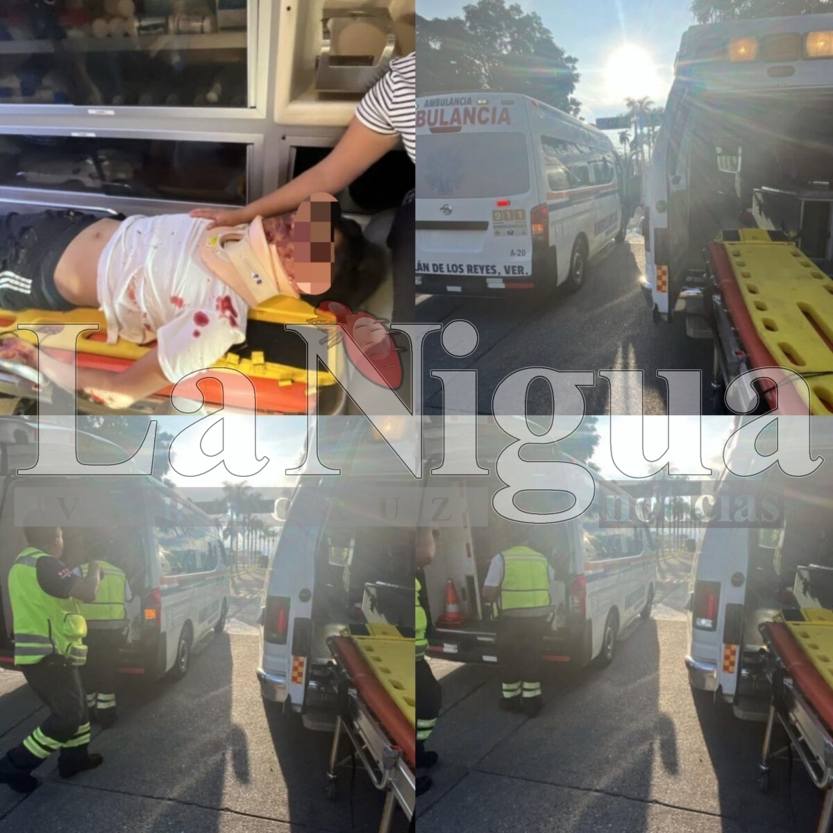 Joven resulta lesionado tras derrapar con su motocicleta 1 polish 20251017 1742277051650076892131048004