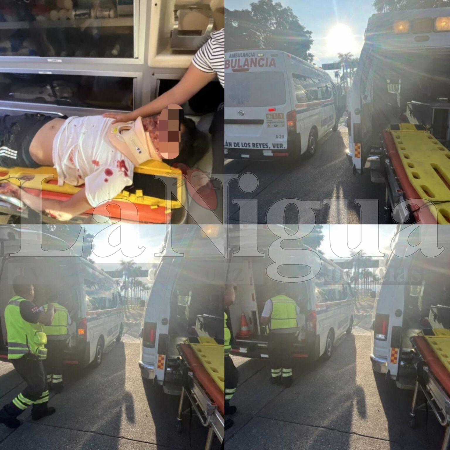 Joven resulta lesionado tras derrapar con su motocicleta