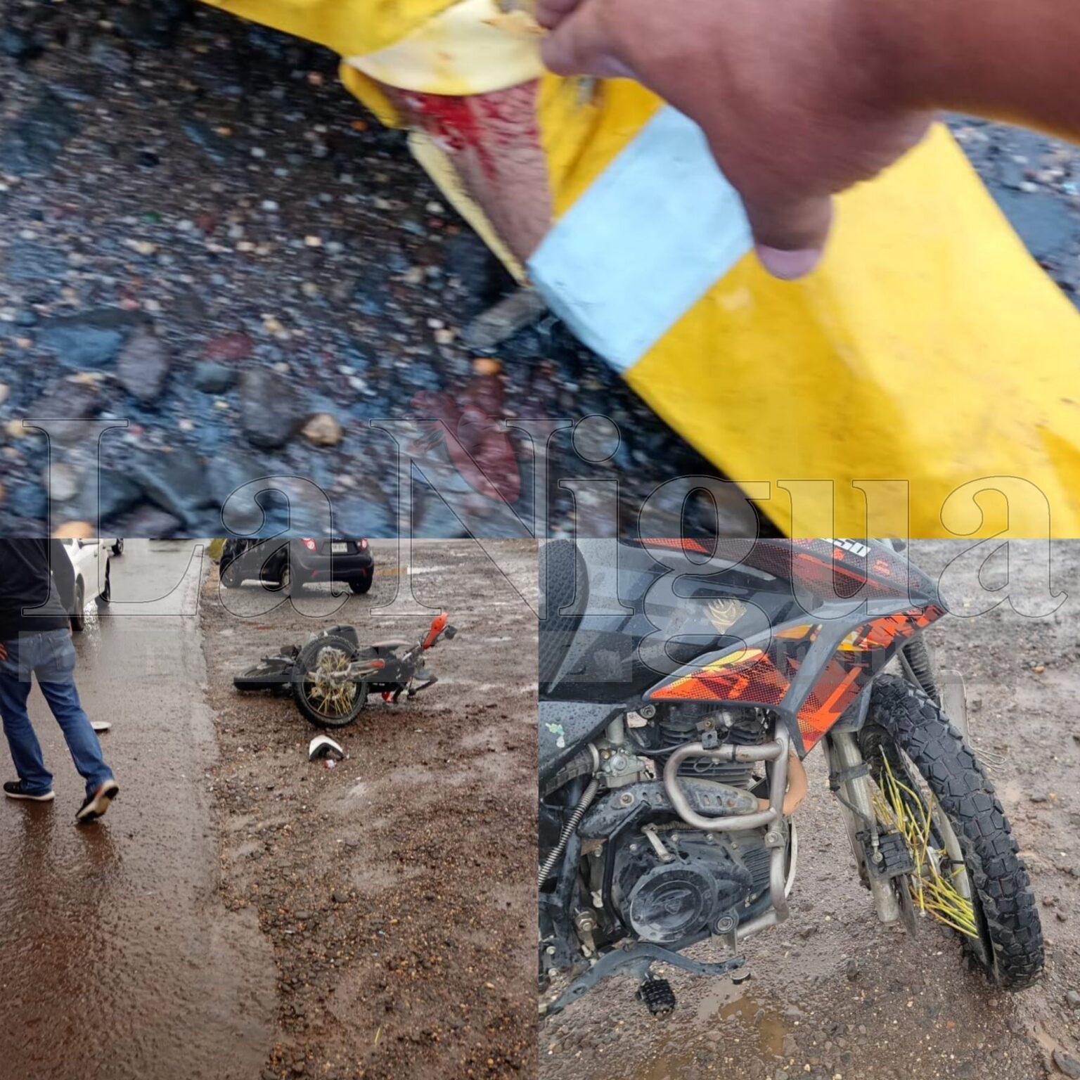 Se accidenta presidente de la liga de softbol bahía .