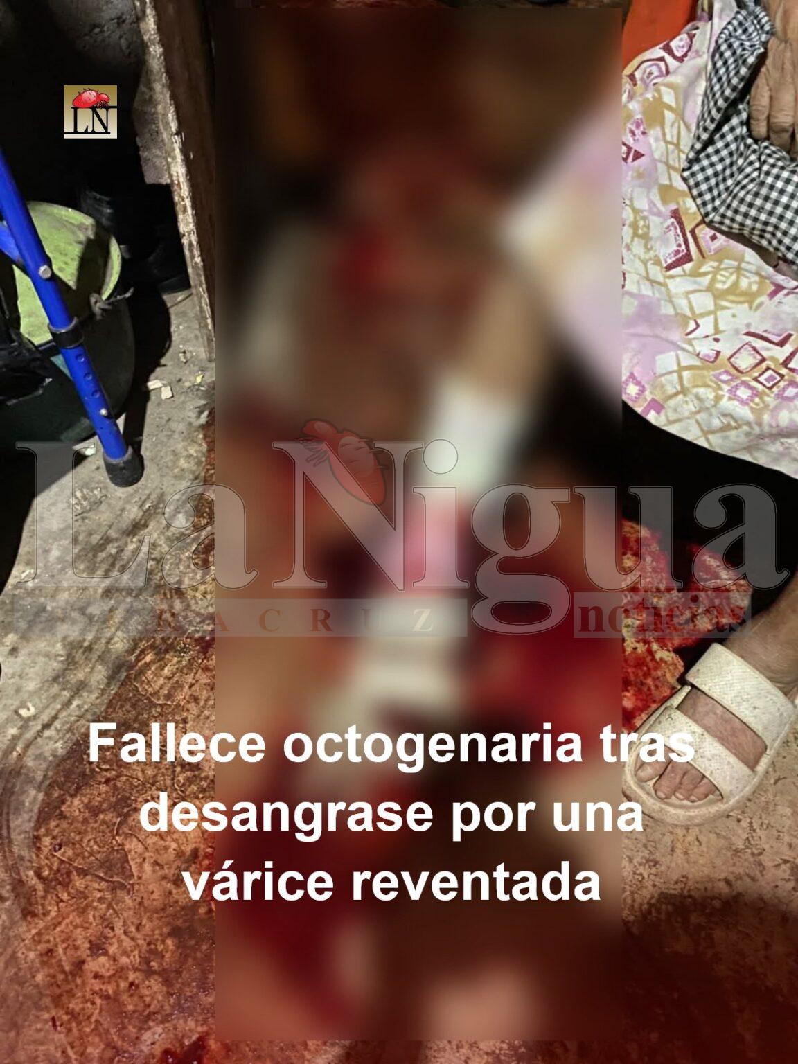 Fallece octogenaria tras desangrarse en su domicilio en San Andrés Tuxtla