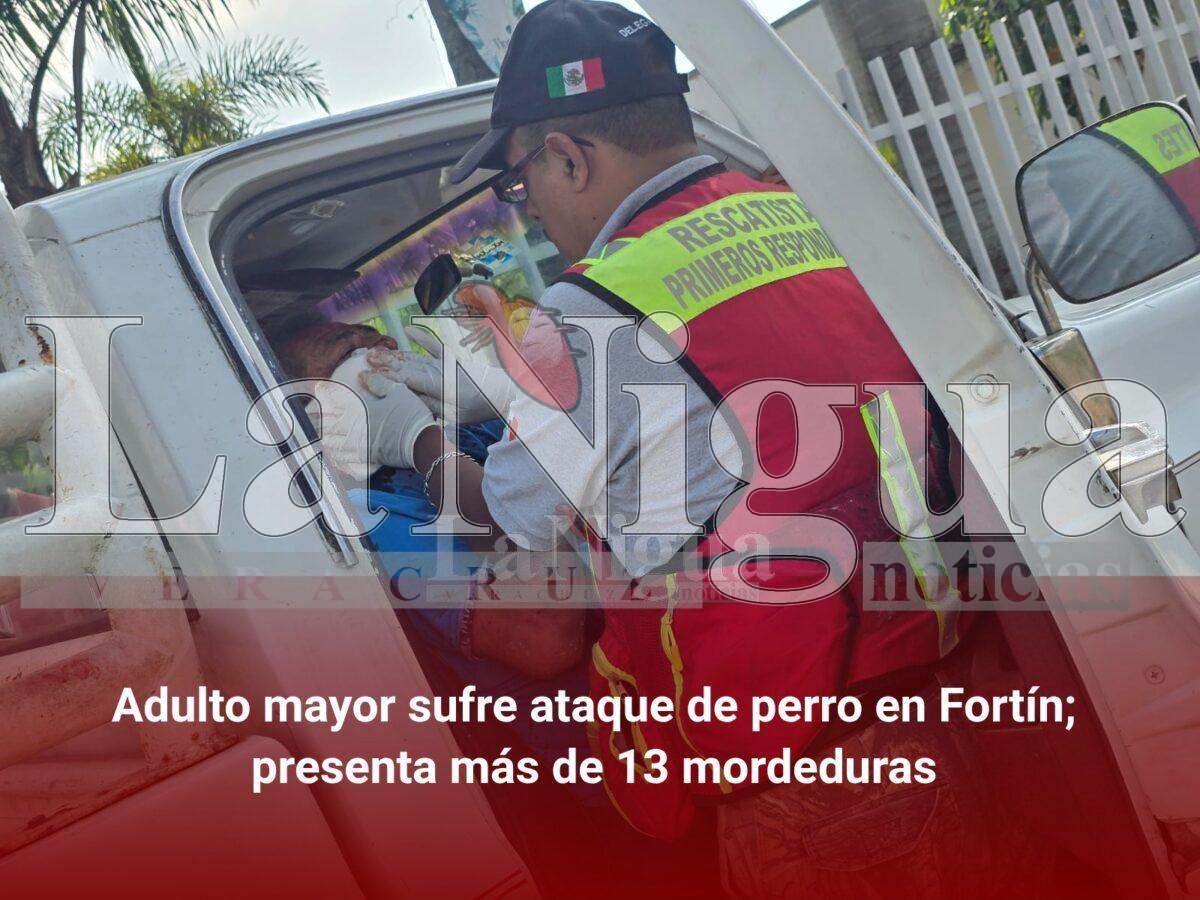Adulto mayor sufre ataque de perro en Fortín; presenta más de 13 mordeduras