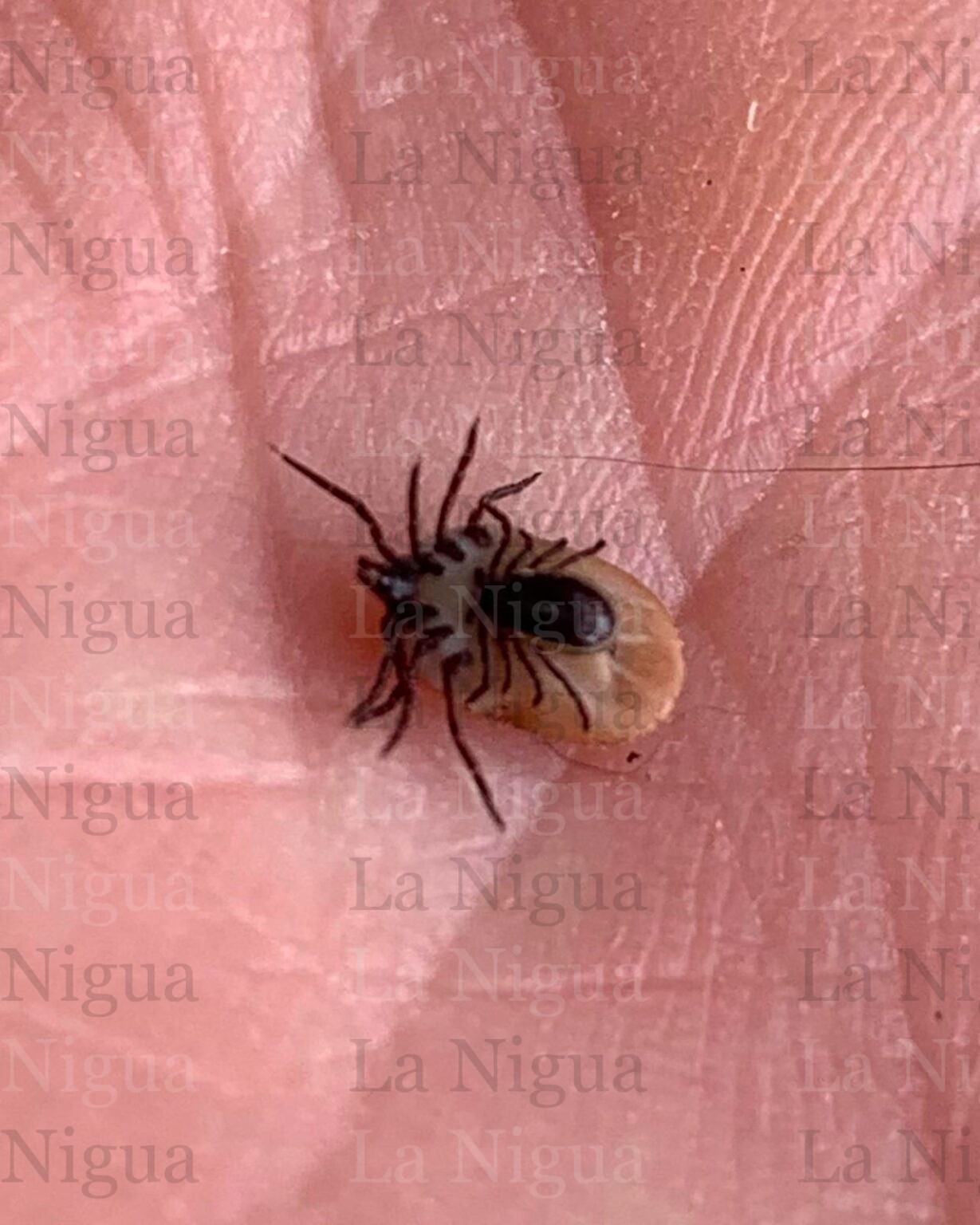 Muere niño de 13 años por picadura de garrapata