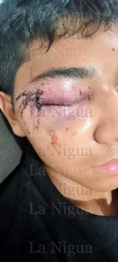 Joven a punto de perder la vista por cobarde golpiza