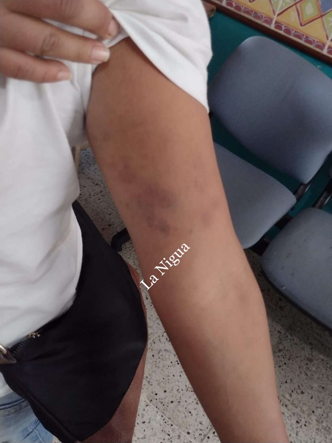 Denuncia agresión periodista por parte de preventivos en Papantla