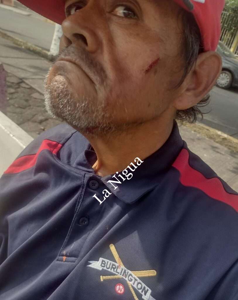 Denuncian negligencia y abusos de familiares  hacia persona discapacitada