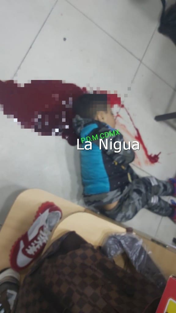 Menor lesionado por disparo de arma de fuego en Cuauhtémoc