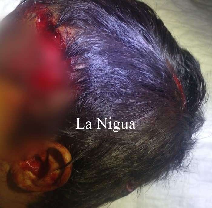 PERRO ATACA A NIÑO DE 3 AÑOS EN COMUNIDAD DE JUAN RODRÍGUEZ CLARA.