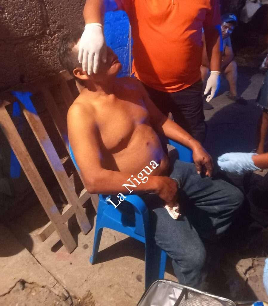 Cuando tronaba artificios, un papanteco, recibió lesiones en el rostro y en una mano.