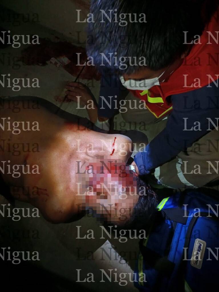 Cae de escaleras y se lesiona