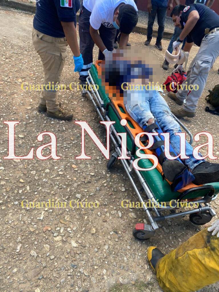 En Acayucan, joven repartidor resultó fuertemente lesionado tras derrapar en motocicleta.