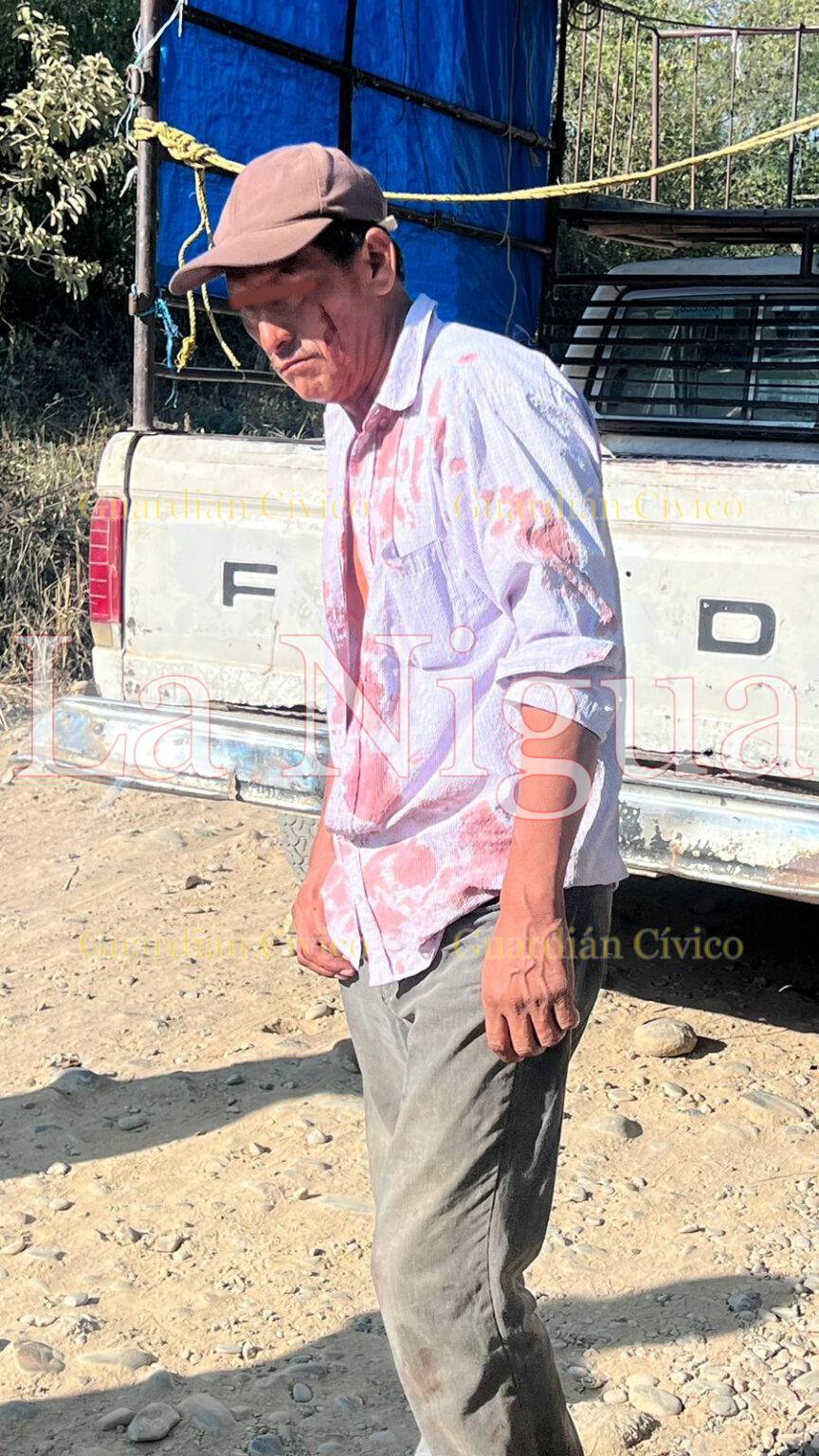 Transportistas se agarran con todo por el pasaje; un herido y un detenido