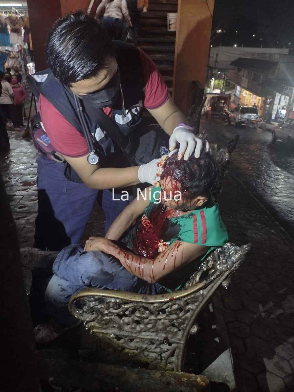 Agreden a parroquiano en pleno centro de Papantla 4 img 20220121 wa00685792524468922152929