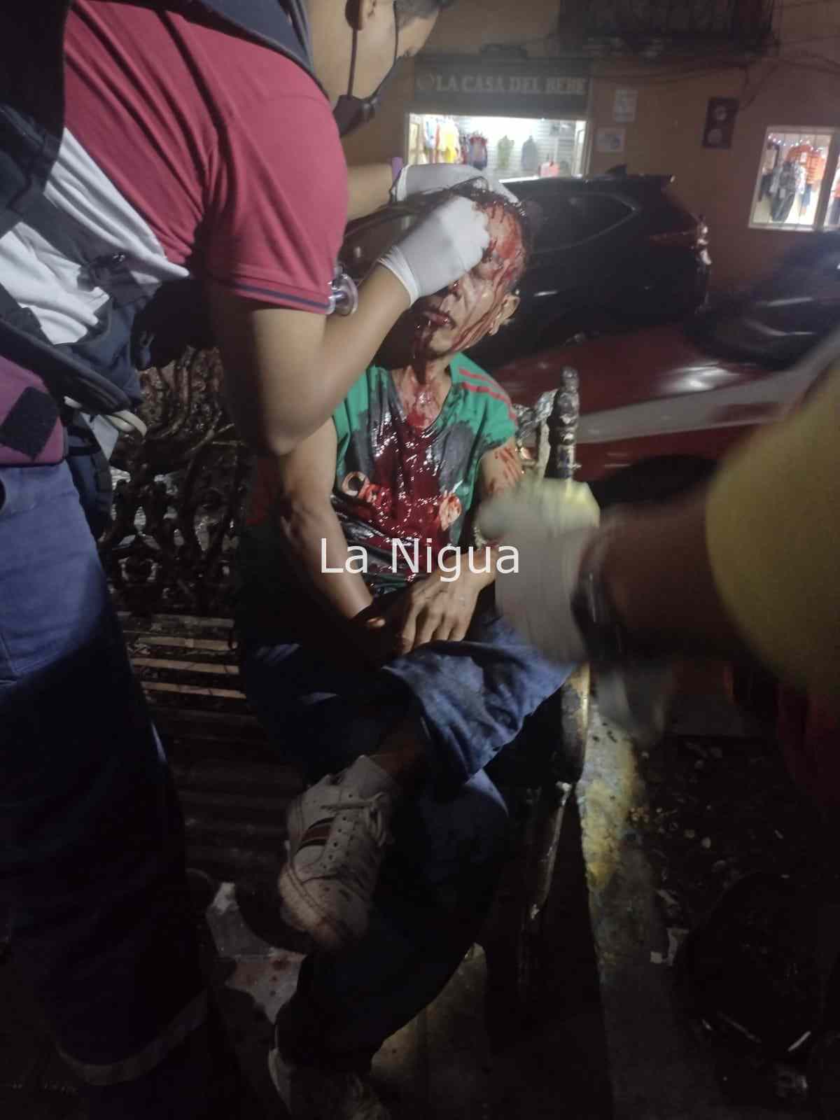 Agreden a parroquiano en pleno centro de Papantla 2 img 20220121 wa00692423429177029369350