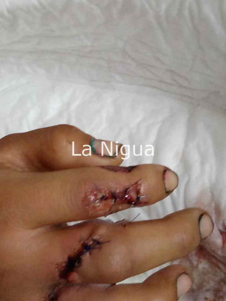 Piden apoyo de alcalde de Xalapa para joven que necesita cirugía en su mano 1 img 20220202 wa00136768005761505854765