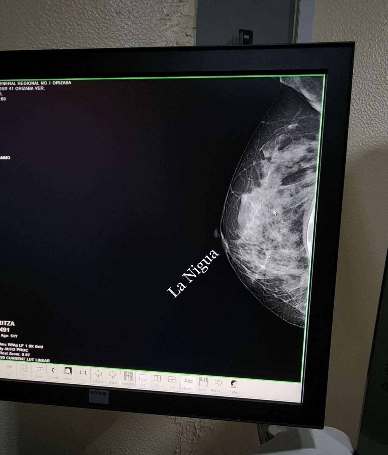 Inicia IMSS Veracruz Sur campaña de mastografías 2023